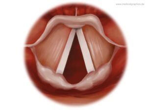 Anatomía cuerdas vocales