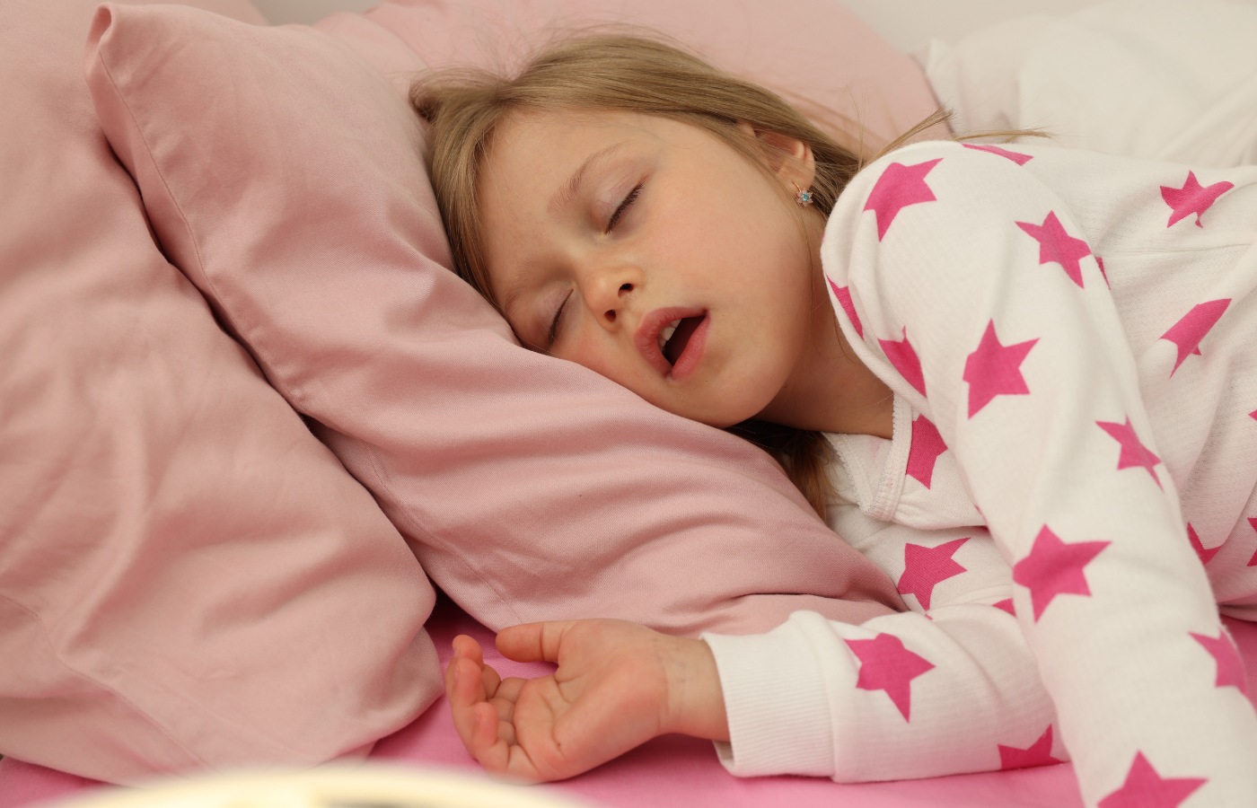 Apnea Obstructiva del Sueño en niños